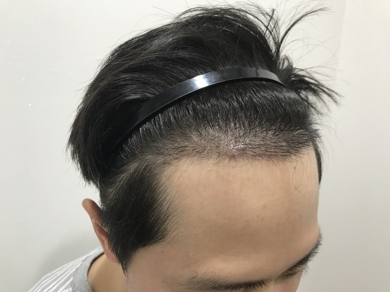 10일차 후기입니다~