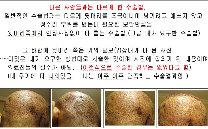 4.뒷머리 많이 봅힌 사진.JPG