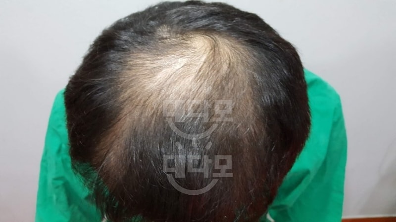 수술 전 1.jpg
