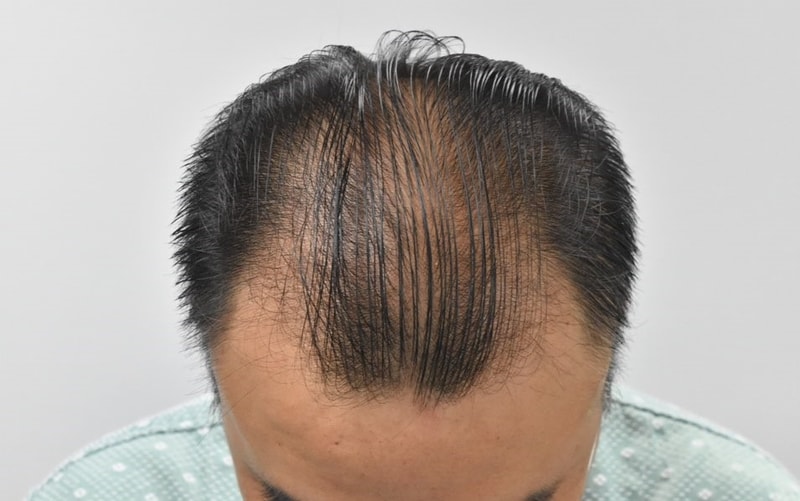 수술전 6.jpg