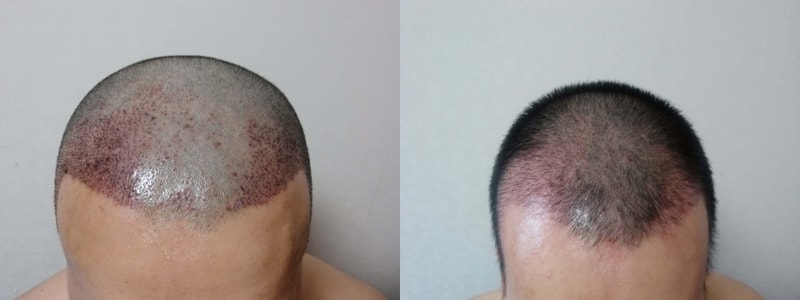 3일,3주.jpg
