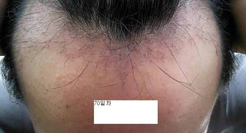 70일차2.jpg