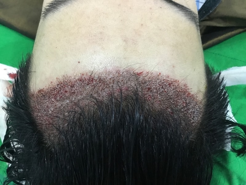 KakaoTalk_20180710_144435781.jpg