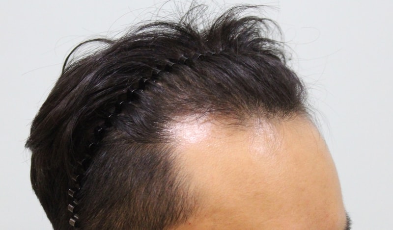 수술전 (2).JPG
