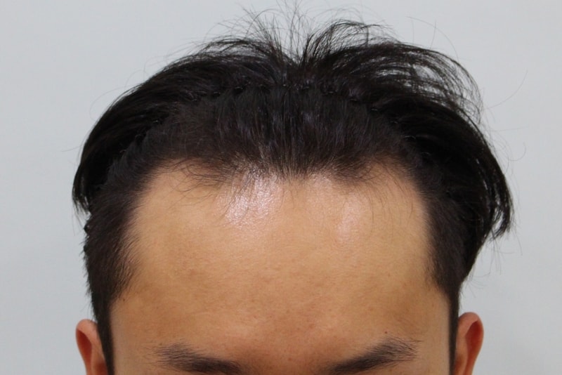 수술전 (9).JPG