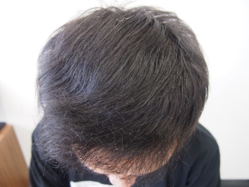 1년 2.JPG