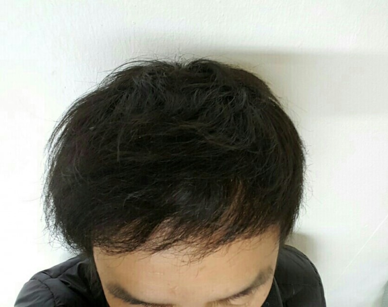 셀카.jpg