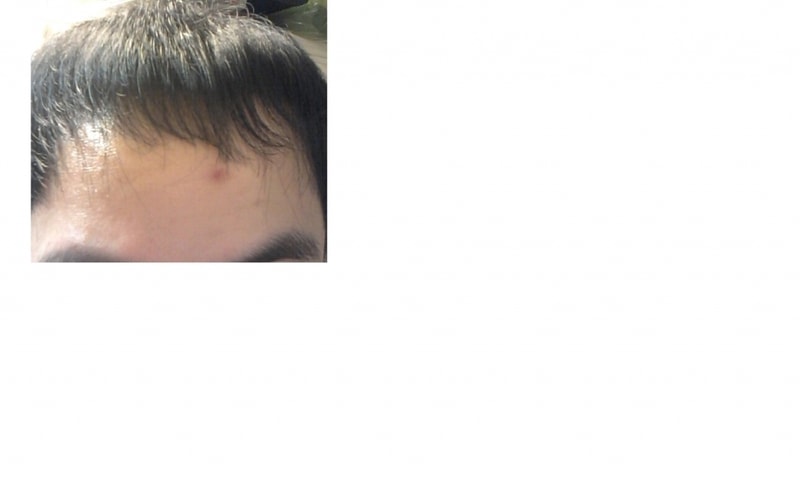 옛날 앞머리.png