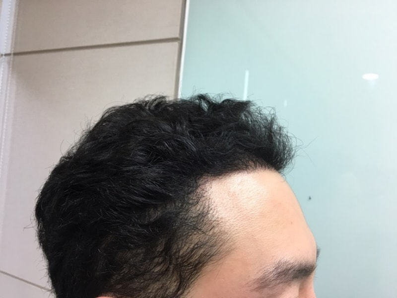 오른쪽.jpg