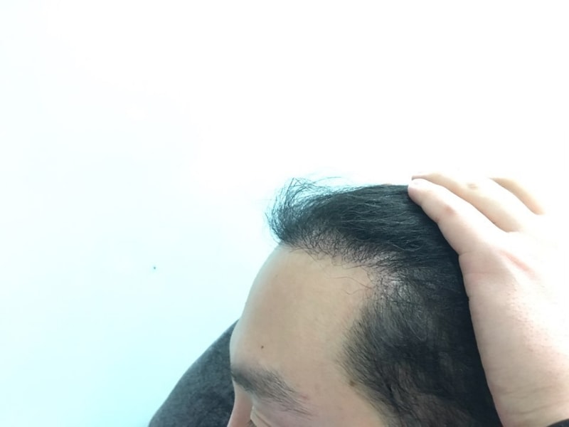 왼쪽.jpg