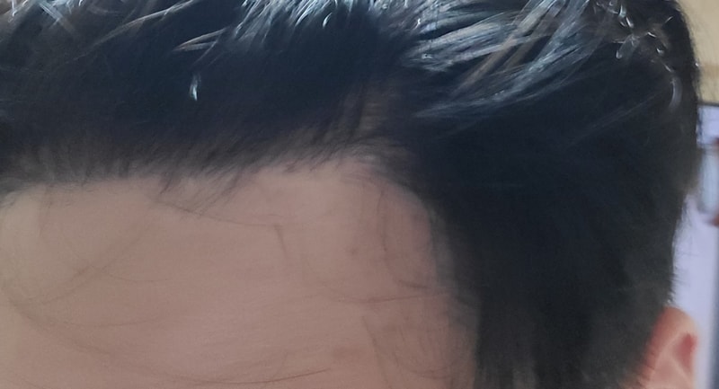 우측.jpg