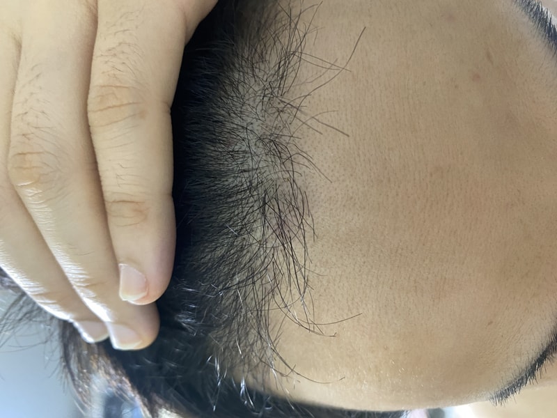 2달하고 6일차 경과사진 밀도