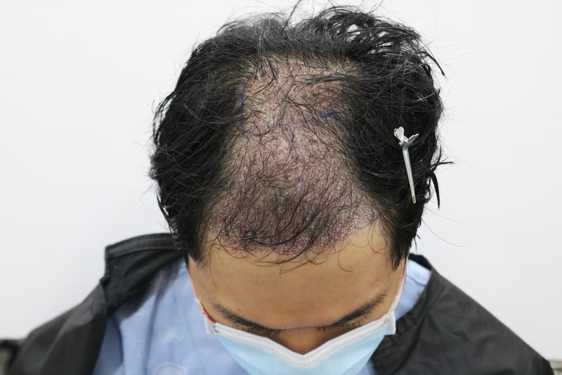 후 1.jpg
