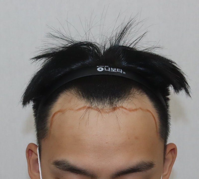 전.jpg