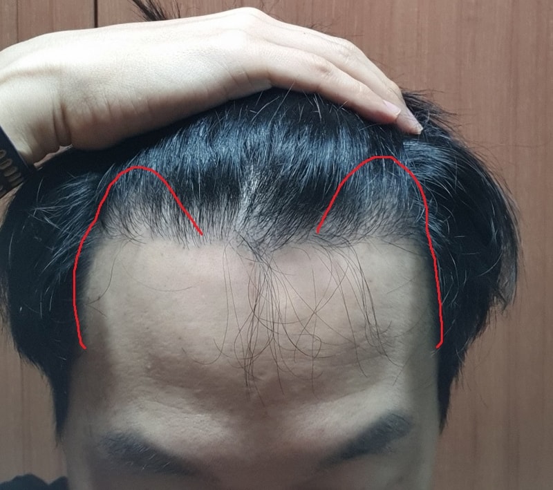 정면심은범위.jpg