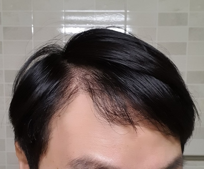 가르마왼쪽.jpg