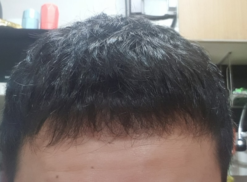 비절개 3천모 220일차 입니다.
