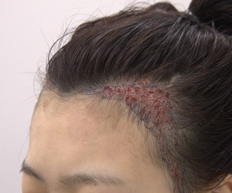 윤후좌.jpg