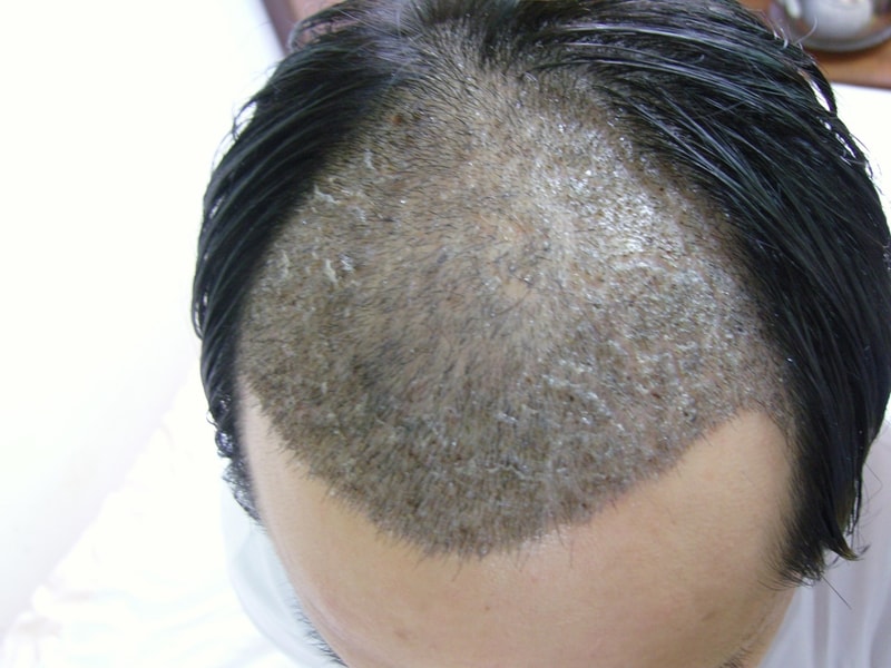 10일된 사진 옆면-1.JPG