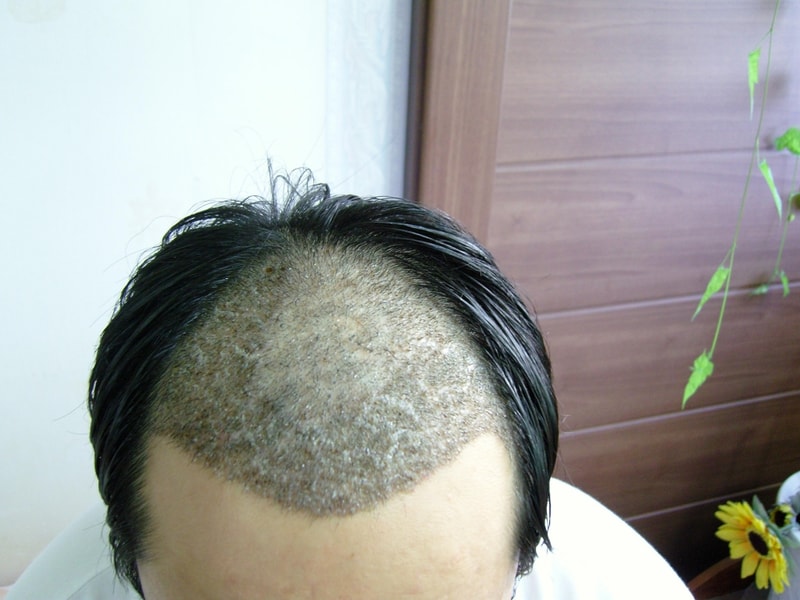 10일된 사진 정면-10.JPG