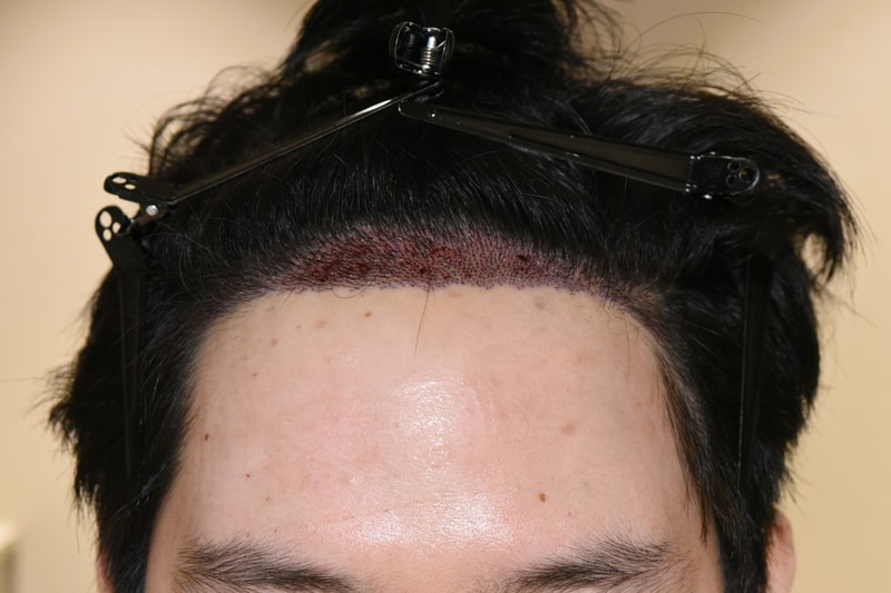 샴푸1일차.jpg