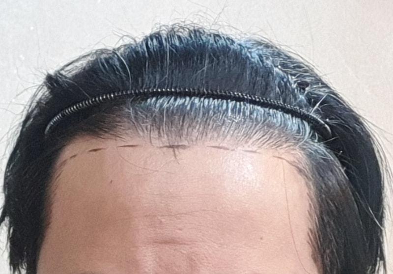 수술 0ㄱ상담.jpg