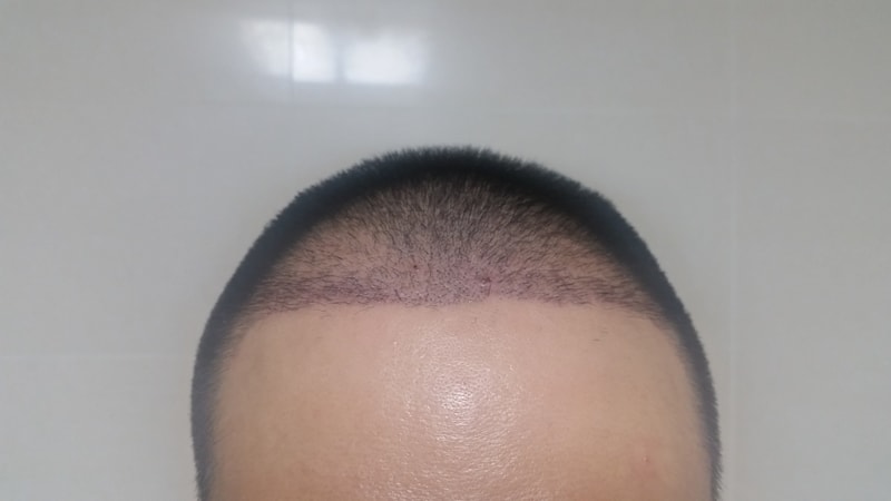 2주5일 현재.jpg
