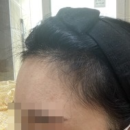 10 3달.jpg