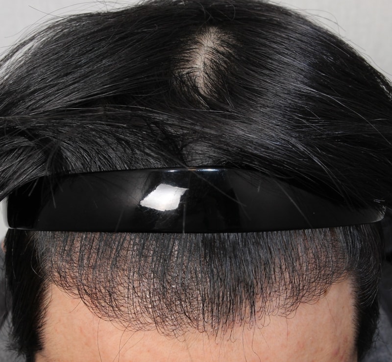 1년후 정면2.jpg