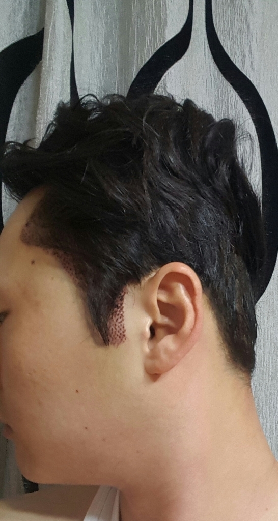 20170322_075316.jpg