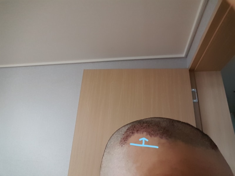 KakaoTalk_20170704_131023600_Ink_LI.jpg