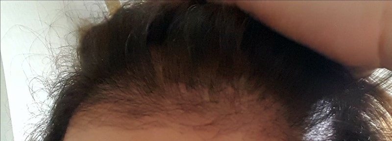 20170711_203351.jpg