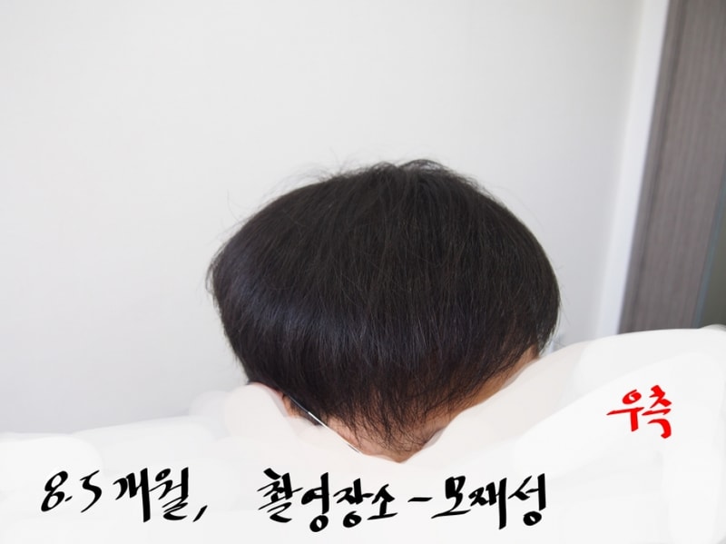 우측.png