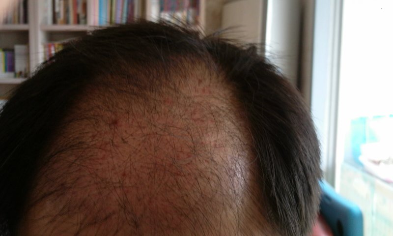 2012-04-15 11.22.44.jpg