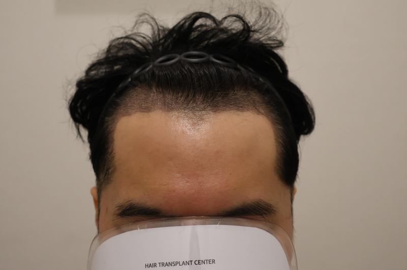 정면후후.png