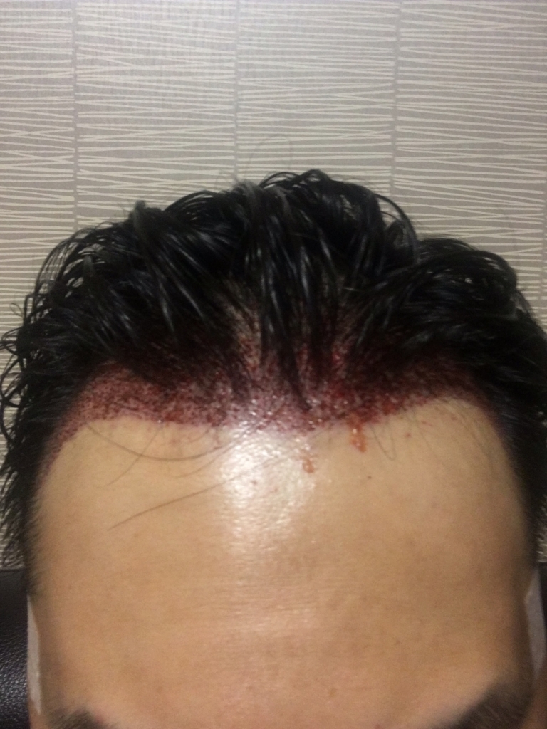 KakaoTalk_20170615_222329659.jpg