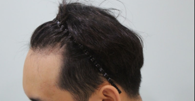 전1.png