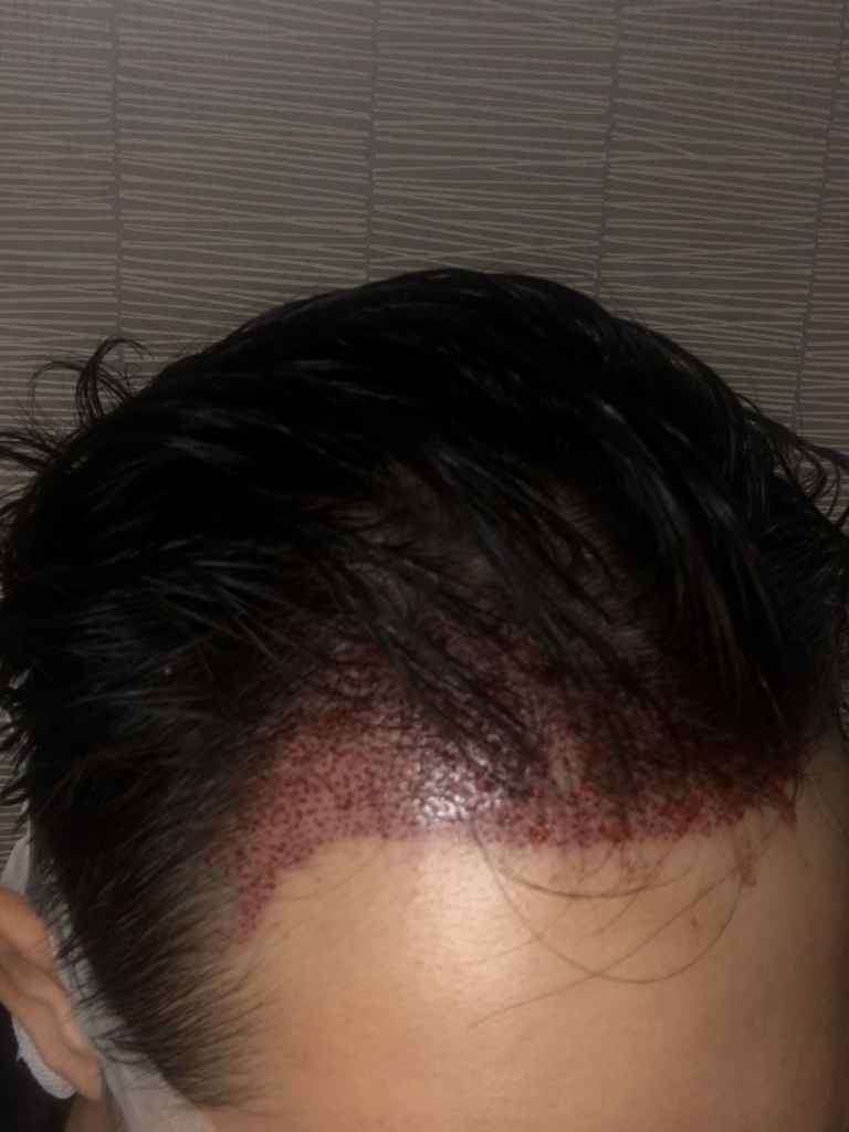 KakaoTalk_20170615_221457360.jpg