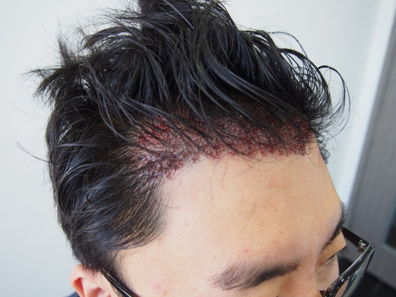수술후 2.JPG