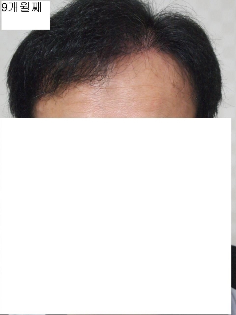 9개월째앞.JPG