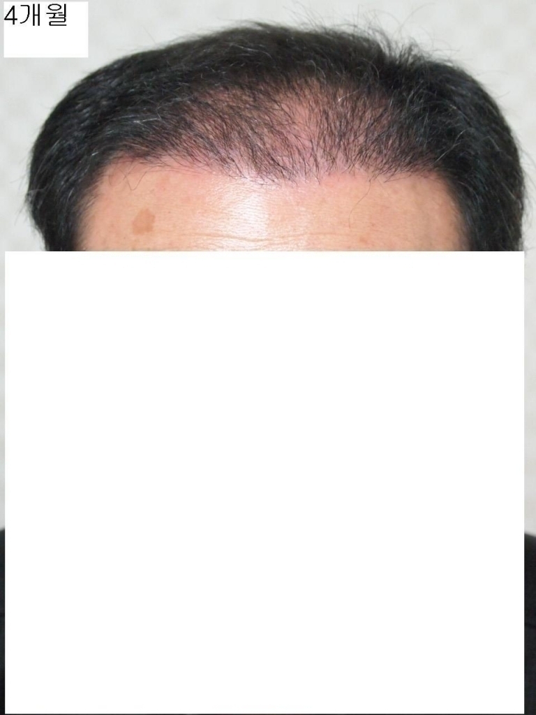 4개월정면.JPG