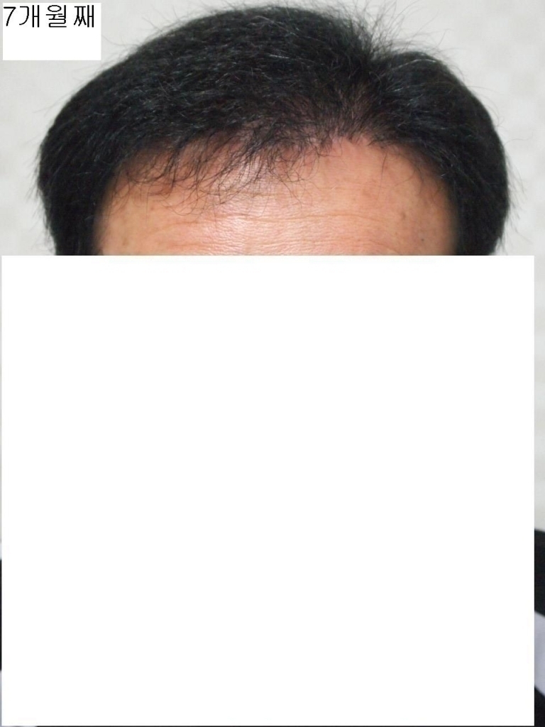 7개월째 정면.JPG