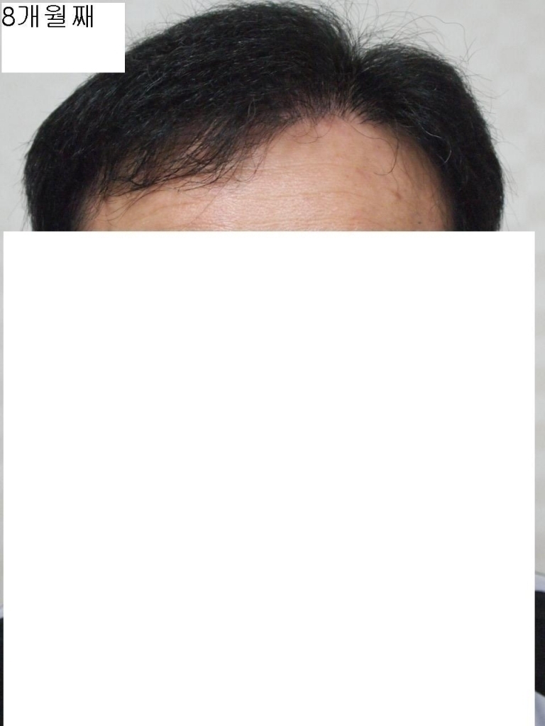 8개월째 정면.JPG