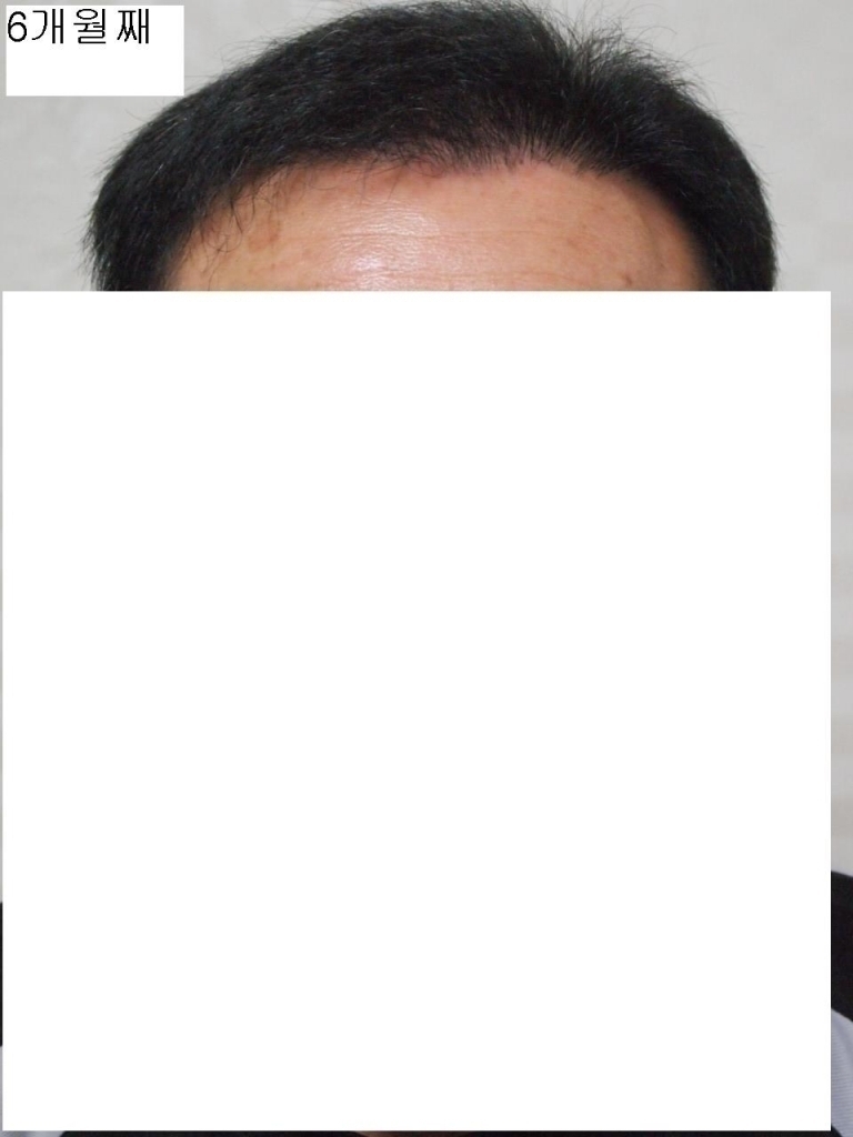 6개월째 정면.JPG