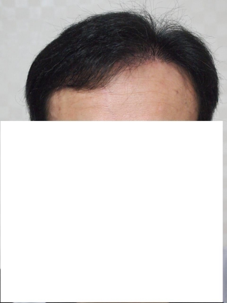 앞머리.JPG
