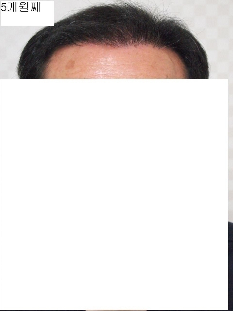 5개월 앞.JPG