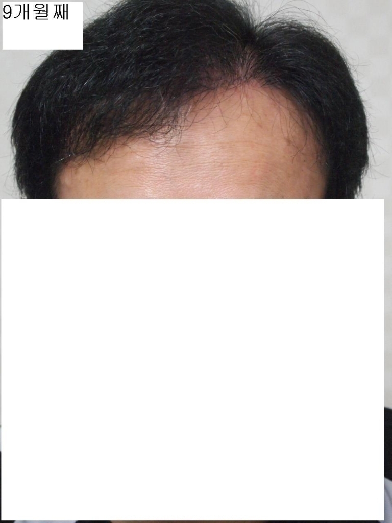 9개월째앞.JPG