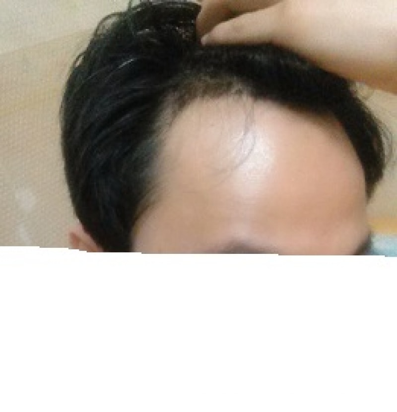 수술1.jpg