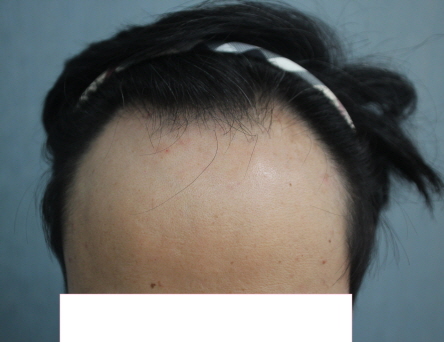 사본 -Before-1.jpg