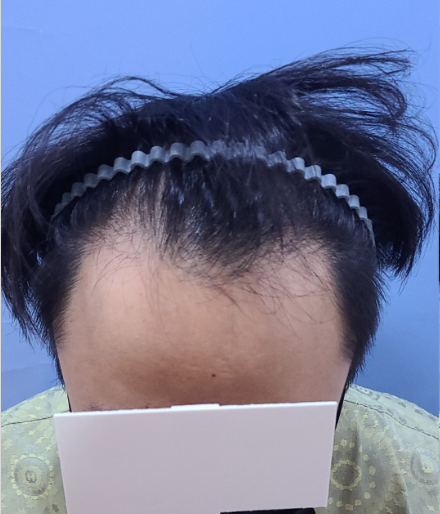 수술전사진.PNG